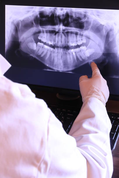 Best Emergency Root Canal Treatment in Pine Bluff, AR
